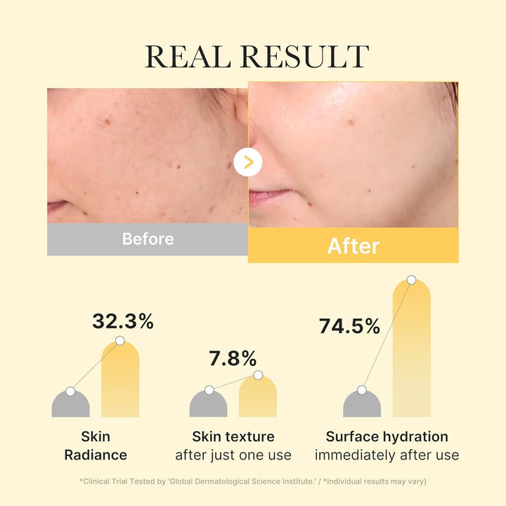 Medicube Sheet Mask-Kojic Acid Turmeric Brightening Gold Jelly Gel Single Mask