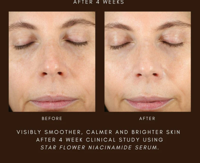 Star Flower Niacinamide Serum 1.5oz