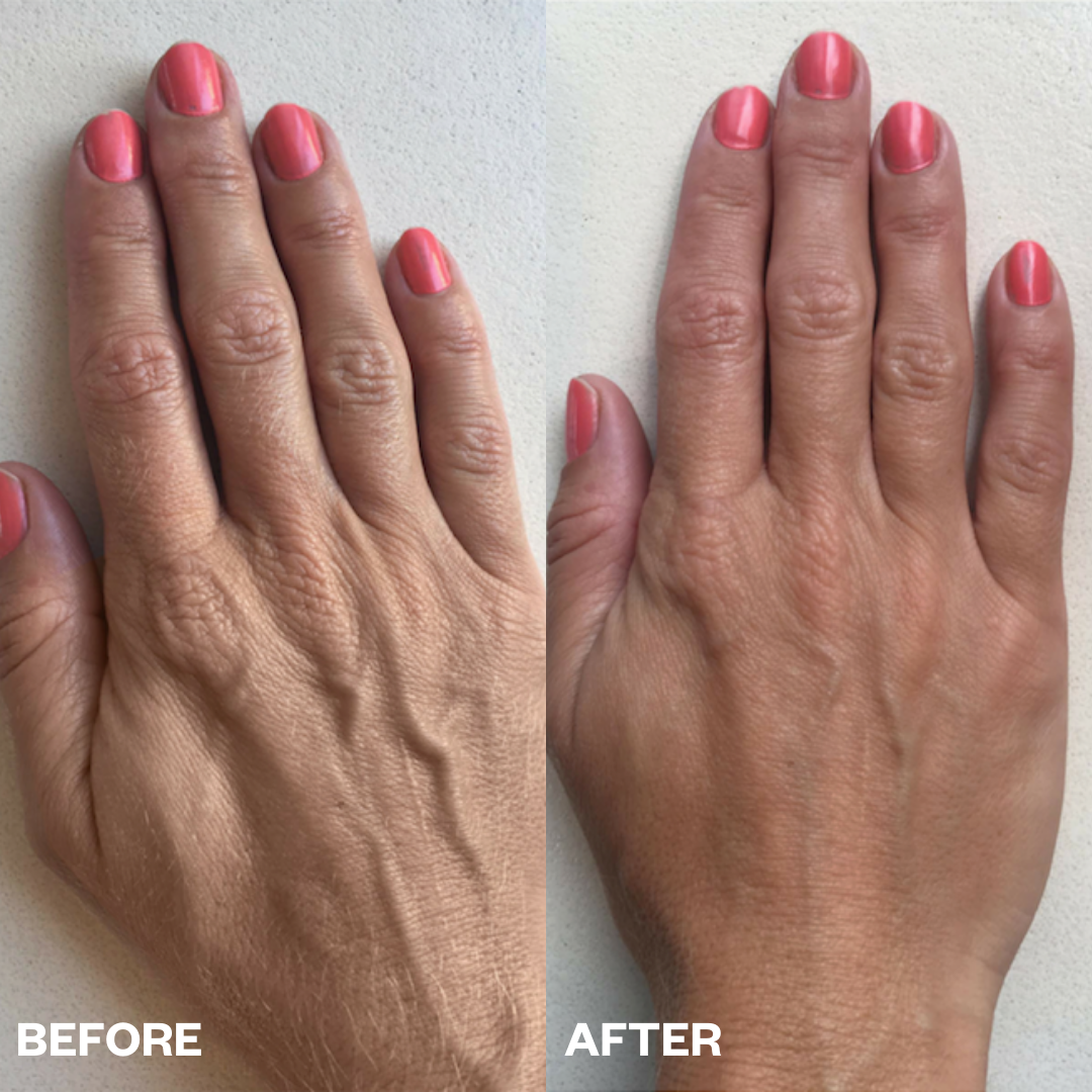 Hand Wrinkle Patches